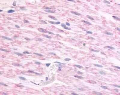 Immunohistochemistry-Paraffin: alpha-2C Adrenergic R/ADRA2C Antibody - BSA Free [NLS3986]