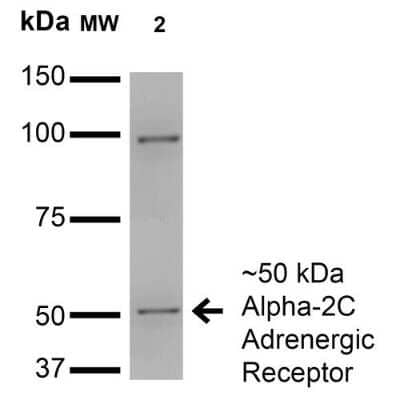 Western Blot: alpha-2C Adrenergic R/ADRA2C Antibody (S330A-80) [NBP2-22397]