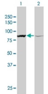 Western Blot: alpha-Actinin 1 Antibody (3F1) [H00000087-M01]