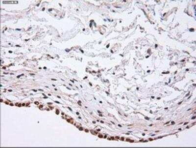 Immunohistochemistry-Paraffin: alpha-Actinin 1 Antibody (OTI7A4) [NBP1-48251]