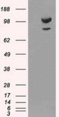 Western Blot: alpha-Actinin 1 Antibody (OTI7A4) [NBP1-48251]