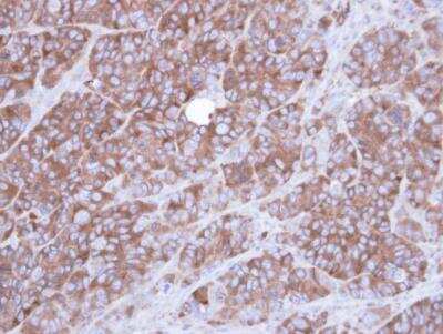 Immunohistochemistry-Paraffin: alpha-Actinin 1 Antibody [NBP1-32578]