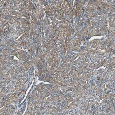 Immunohistochemistry-Paraffin: alpha-Actinin 1 Antibody [NBP1-85791]