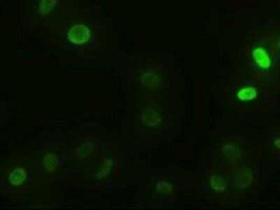 Immunocytochemistry/ Immunofluorescence: alpha-Actinin 1 Antibody (OTI7A4) - Azide and BSA Free [NBP2-70078]