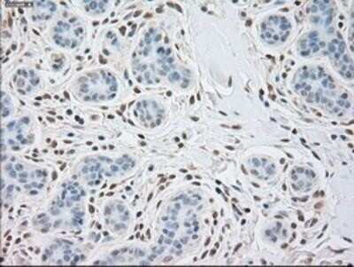Immunohistochemistry: alpha-Actinin 1 Antibody (OTI7A4) - Azide and BSA Free [NBP2-70078]