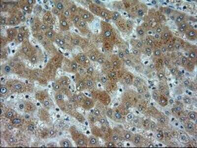 Immunohistochemistry: alpha-Actinin 1 Antibody (OTI7A4) - Azide and BSA Free [NBP2-70078]