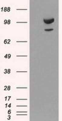 Western Blot: alpha-Actinin 1 Antibody (OTI7A4)Azide and BSA Free [NBP2-70078]