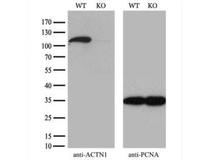 Knockout Validated: alpha-Actinin 1 Antibody (OTI7A4) [NBP1-48251]