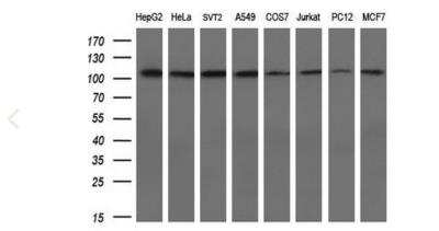 Western Blot: alpha-Actinin 1 Antibody (OTI7A4) [NBP1-48251]