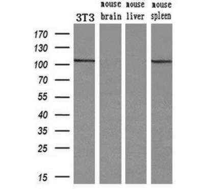 Western Blot: alpha-Actinin 1 Antibody (OTI7A4) [NBP1-48251]