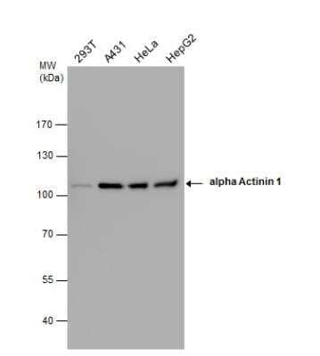 Western Blot: alpha-Actinin 1 Antibody [NBP1-32578]