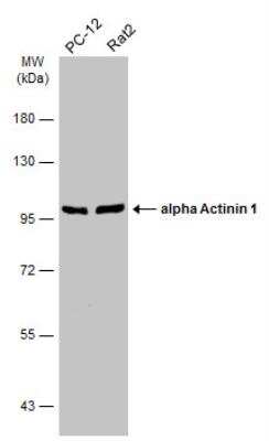 Western Blot: alpha-Actinin 1 Antibody [NBP1-32578]