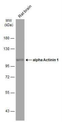 Western Blot: alpha-Actinin 1 Antibody [NBP1-32578]