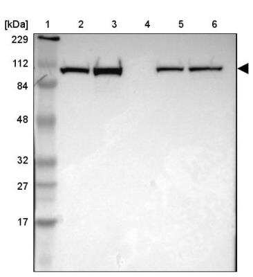 Western Blot: alpha-Actinin 1 Antibody [NBP1-85791]