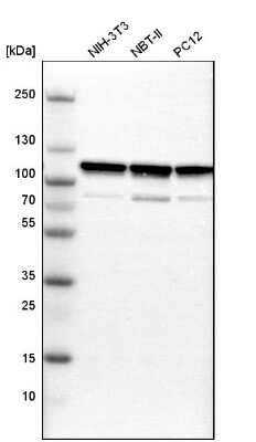 Western Blot: alpha-Actinin 1 Antibody [NBP1-85791]