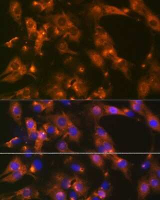 Immunocytochemistry/ Immunofluorescence: alpha Adaptin Antibody (8R8B6) [NBP3-16402]