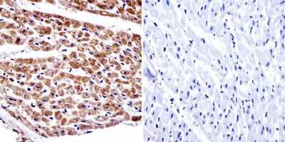 Immunohistochemistry-Paraffin: alpha Adaptin Antibody (AC1-M11) - BSA Free [NB300-721]