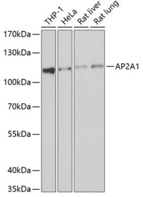 Western Blot: alpha Adaptin AntibodyBSA Free [NBP2-92798]