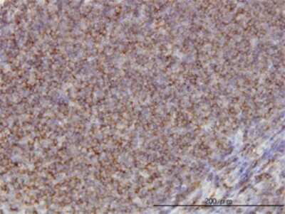 Immunohistochemistry-Paraffin: alpha Adducin Antibody (2C9) [H00000118-M01]