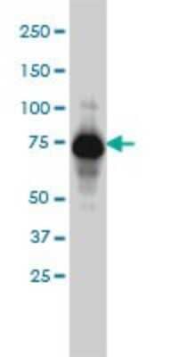 Western Blot: alpha Adducin Antibody (2C9) [H00000118-M01]