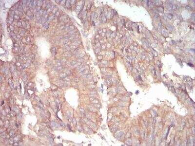 Immunohistochemistry-Paraffin: alpha Adducin Antibody (5D4H1) - BSA Free [NBP2-52409]