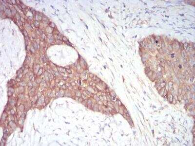Immunohistochemistry-Paraffin: alpha Adducin Antibody (5D4H1) - BSA Free [NBP2-52409]