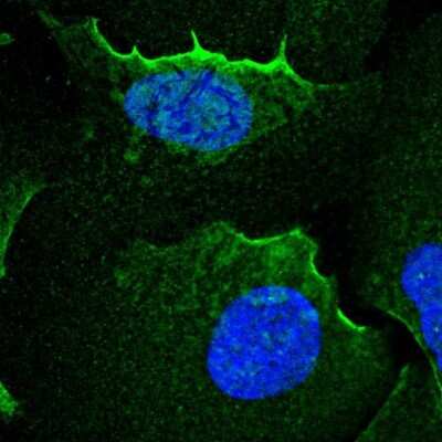 Immunocytochemistry/ Immunofluorescence: alpha Adducin Antibody [NBP2-38268]