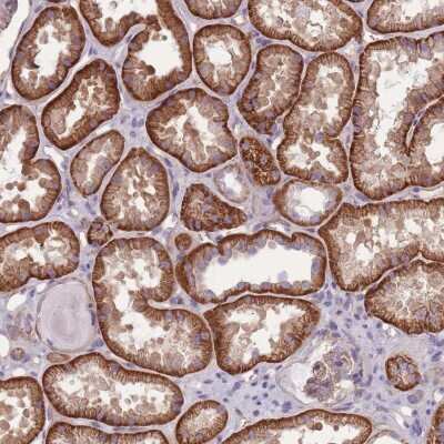 Immunohistochemistry: alpha Adducin Antibody [NBP2-38268]