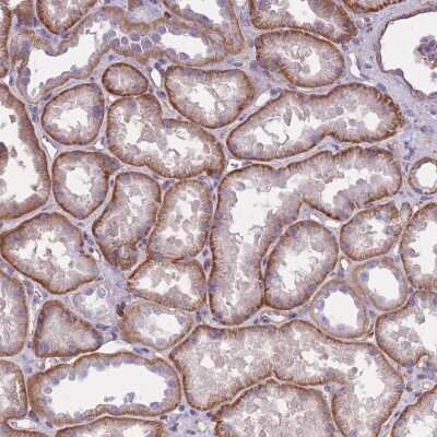 Immunohistochemistry: alpha Adducin Antibody [NBP2-38269]