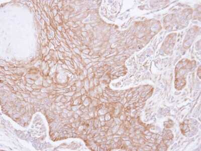 Immunohistochemistry-Paraffin: alpha Adducin Antibody [NBP2-15359]