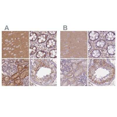 Immunohistochemistry-Paraffin: alpha Adducin Antibody [NBP2-38268]