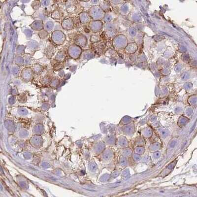 Immunohistochemistry-Paraffin: alpha Adducin Antibody [NBP2-38268]