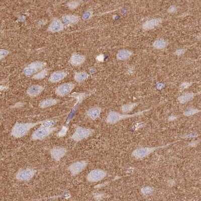 Immunohistochemistry-Paraffin: alpha Adducin Antibody [NBP2-38268]