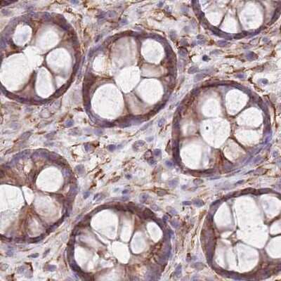 Immunohistochemistry-Paraffin: alpha Adducin Antibody [NBP2-38268]