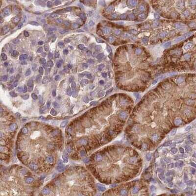 Immunohistochemistry-Paraffin: alpha Adducin Antibody [NBP2-38268]