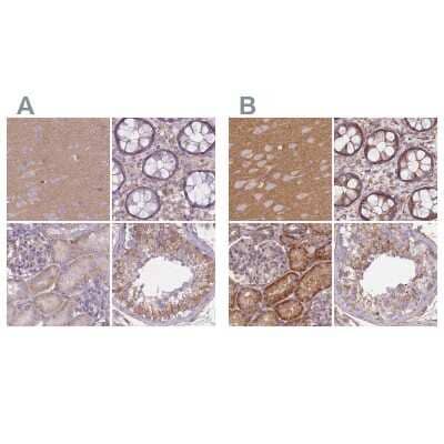 Immunohistochemistry-Paraffin: alpha Adducin Antibody [NBP2-38269]