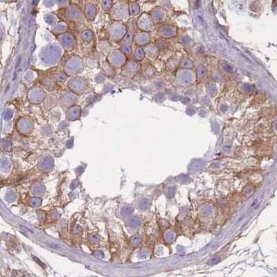 Immunohistochemistry-Paraffin: alpha Adducin Antibody [NBP2-38269]