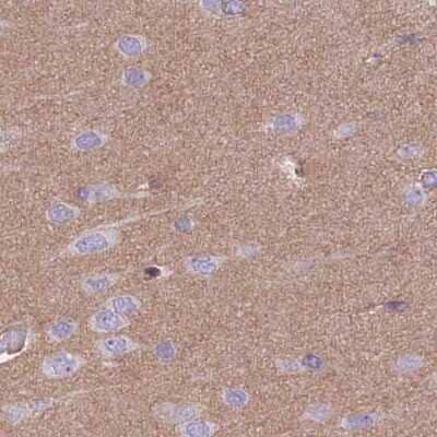 Immunohistochemistry-Paraffin: alpha Adducin Antibody [NBP2-38269]