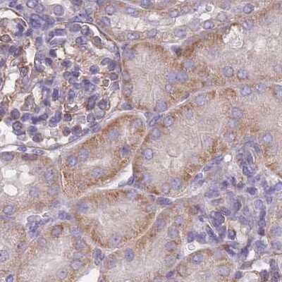 Immunohistochemistry-Paraffin: alpha Adducin Antibody [NBP2-38269]