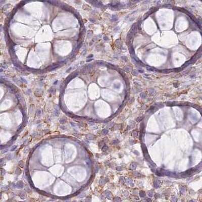Immunohistochemistry-Paraffin: alpha Adducin Antibody [NBP2-38269]