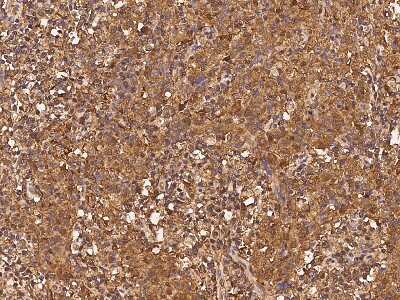 Immunohistochemistry-Paraffin: alpha Adducin Antibody [NBP2-99388]