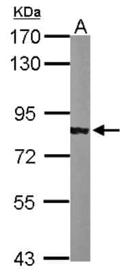 Western Blot: alpha Adducin Antibody [NBP2-15359]