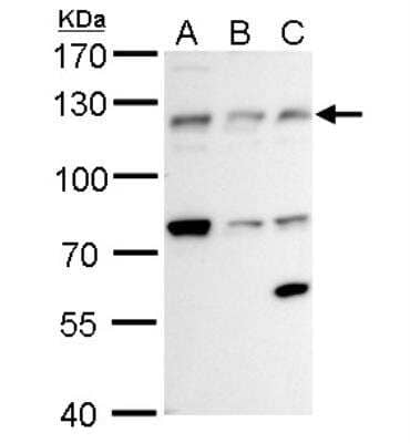 Western Blot: alpha Adducin Antibody [NBP2-15359]