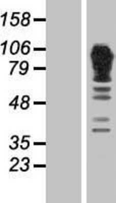 Western Blot: alpha Adducin Overexpression Lysate [NBP2-10946]