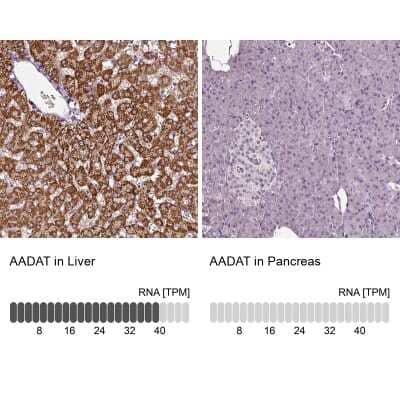 Immunohistochemistry-Paraffin: alpha-Aminoadipate Aminotransferase Antibody [NBP1-89627]