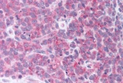 Immunohistochemistry-Paraffin: alpha-Aminoadipate Aminotransferase Antibody [NBP3-14538]