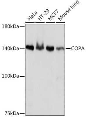 Western Blot: alpha COP I Antibody (3W6Y6) [NBP3-15839]