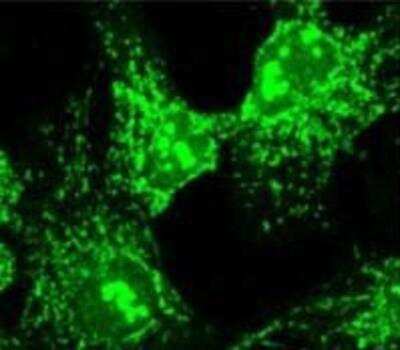 Immunocytochemistry/ Immunofluorescence: alpha COP I Antibody [NB120-2913]