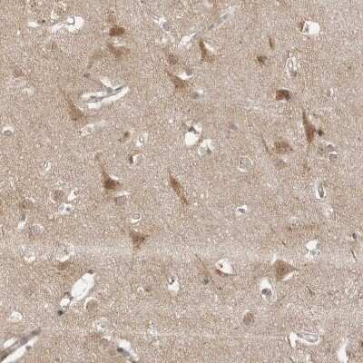 Immunohistochemistry-Paraffin: alpha COP I Antibody [NBP1-89705]