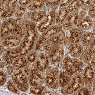 Immunohistochemistry-Paraffin: alpha COP I Antibody [NBP1-89705]